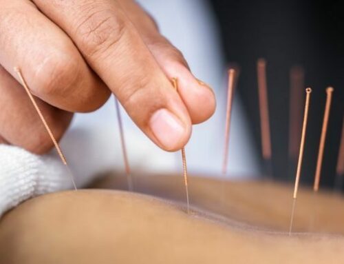 The Role of Acupuncture in Treating Chronic Pain