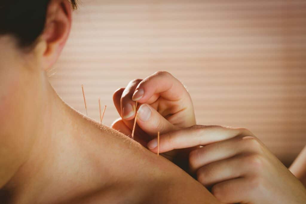 Acupuncture Therapy D'vida Injury Clinic