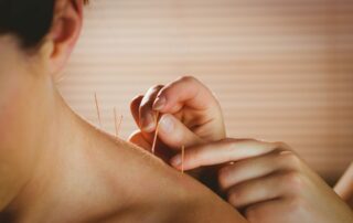 Acupuncture Therapy D'vida Injury Clinic